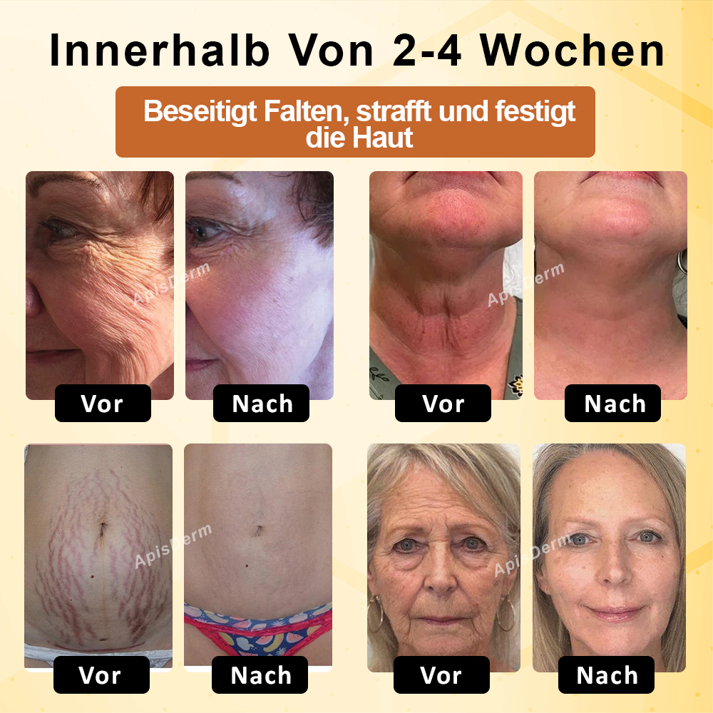 ApisDerm™ BotoxBee Fortschrittliche Multi-Aktions Straffungscreme