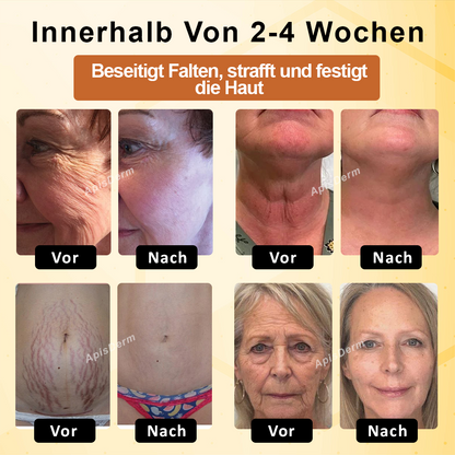 ApisDerm™ BotoxBee Fortschrittliche Multi-Aktions Straffungscreme