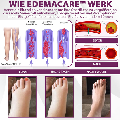 EdemaCare™ Holunderbeer Lymphdrainage Massagecreme