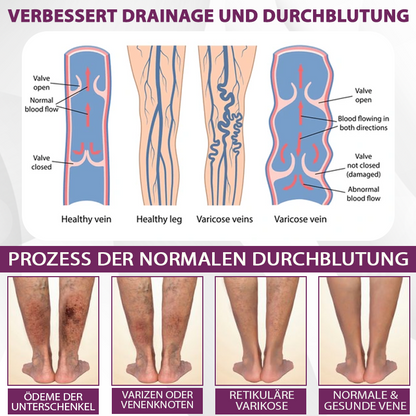 EdemaCare™ Holunderbeer Lymphdrainage Massagecreme