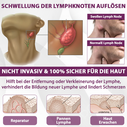 EdemaCare™ Holunderbeer Lymphdrainage Massagecreme