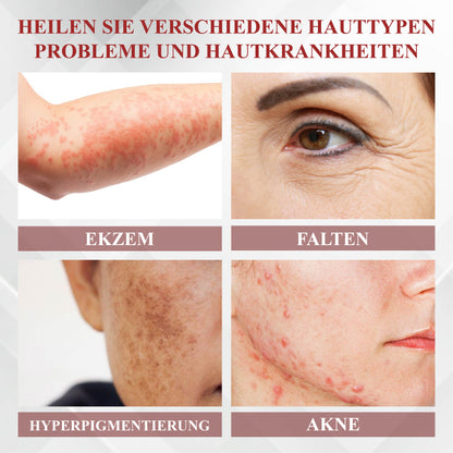 RelievaDerm™ EmuÖl Hauttherapie Botanische Salbe