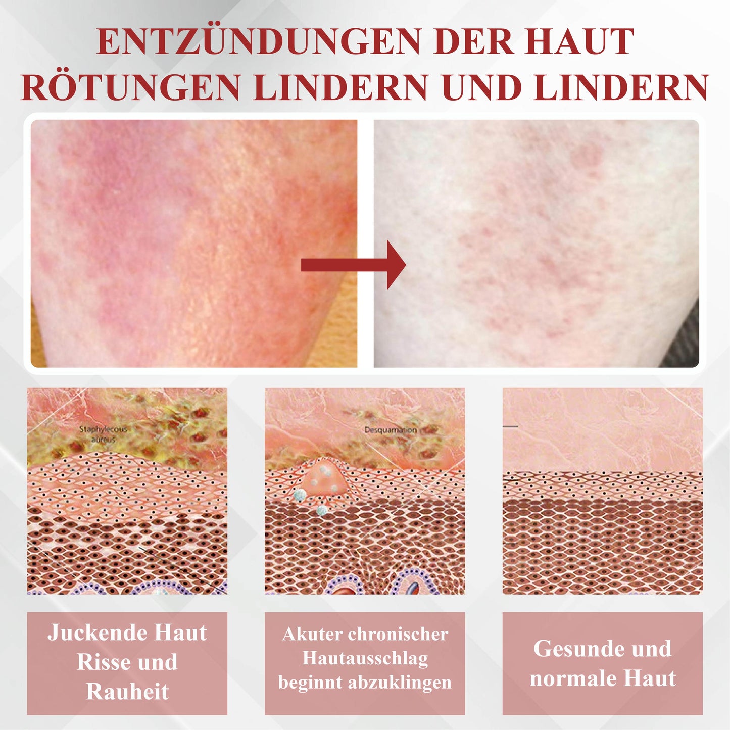 RelievaDerm™ EmuÖl Hauttherapie Botanische Salbe