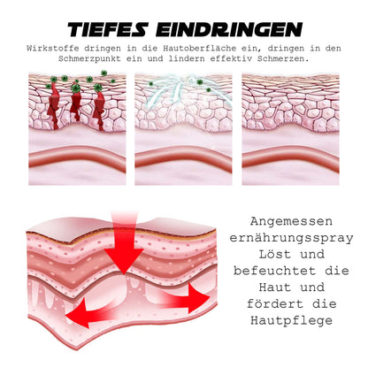 ATTDX AthletenFuß FungusRelief BehandlungSprühen